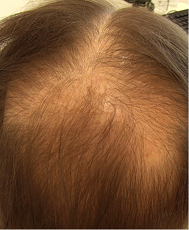 before-img-1