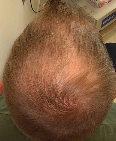 before-img-2